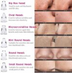 Black Head Remover - Image 2